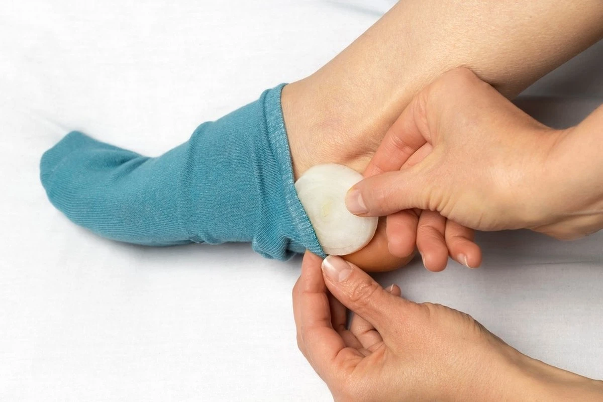 Cebolla en los calcetines, microondas para la ropa interior: los trucos caseros que sorprenden - image 1