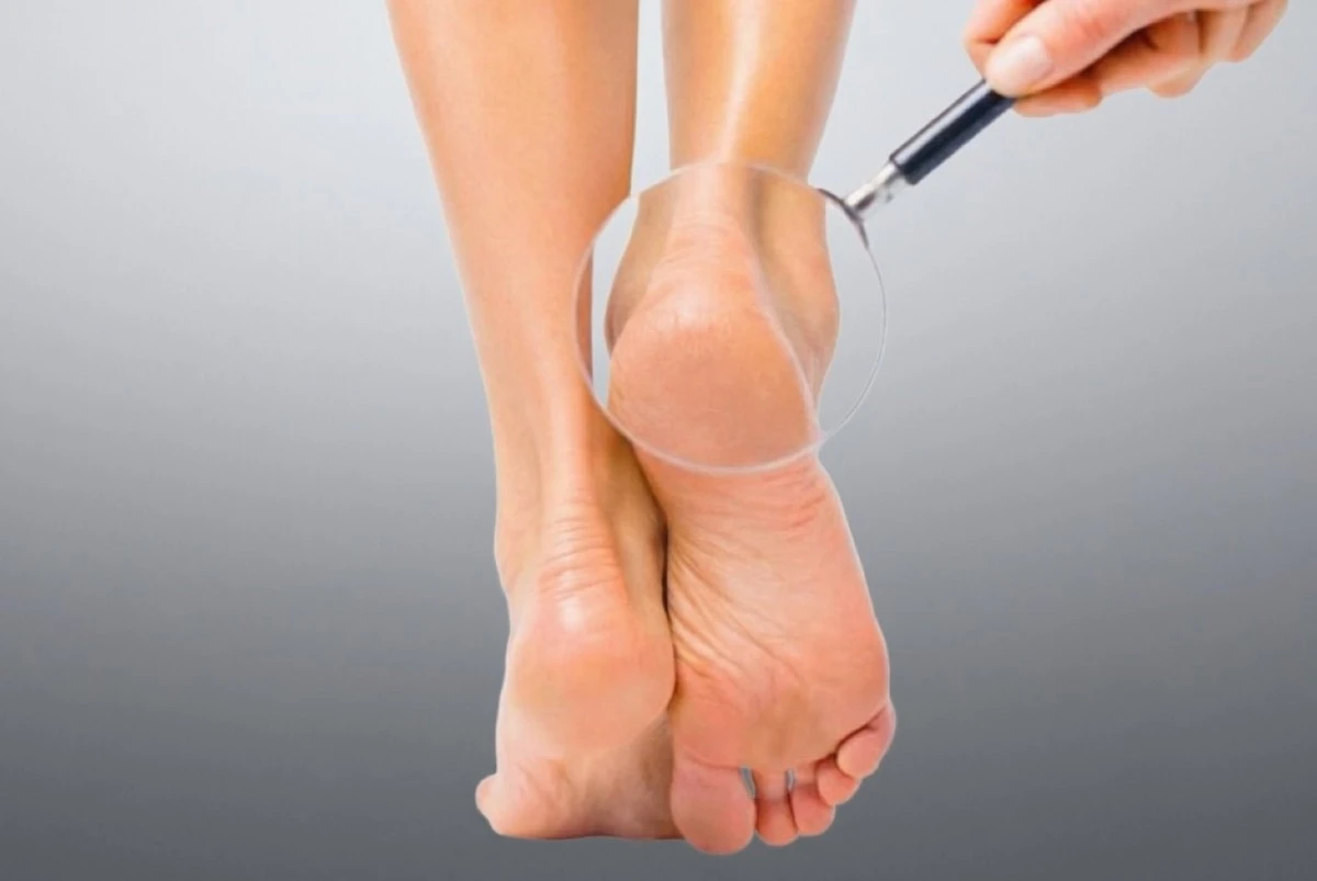 Talones de seda sin piedra pómez: el secreto casero que te sorprenderá